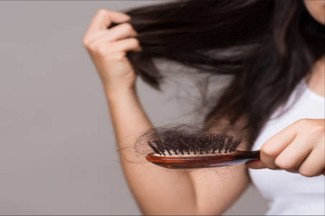 Experiencing sudden hairfall during rains?